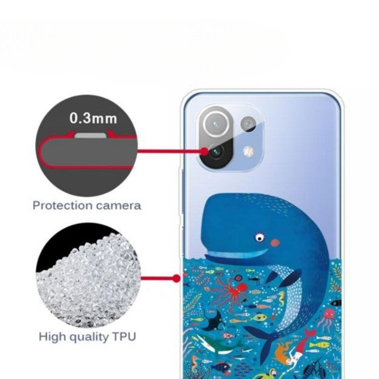 Ovitek za telefon "Whales" Xiaomi Mi 11 Lite – Infostyle